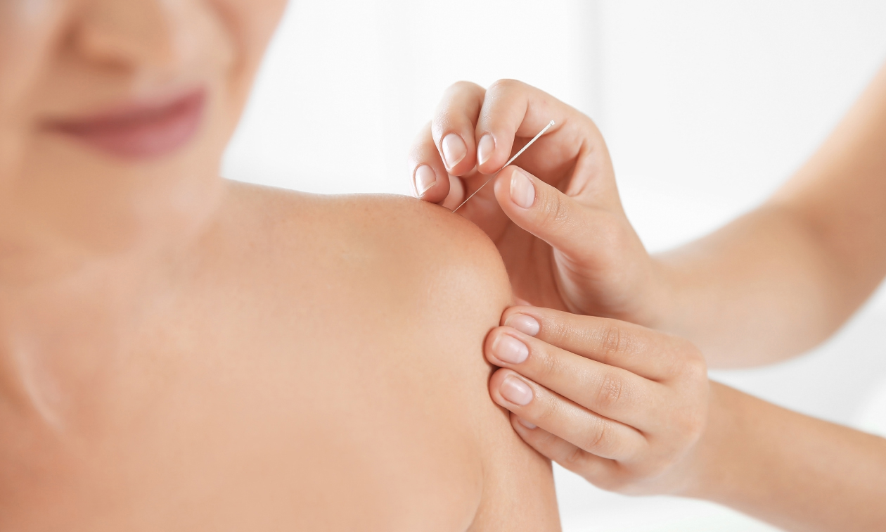Acupunctuur & Cupping Patricia Jacobs