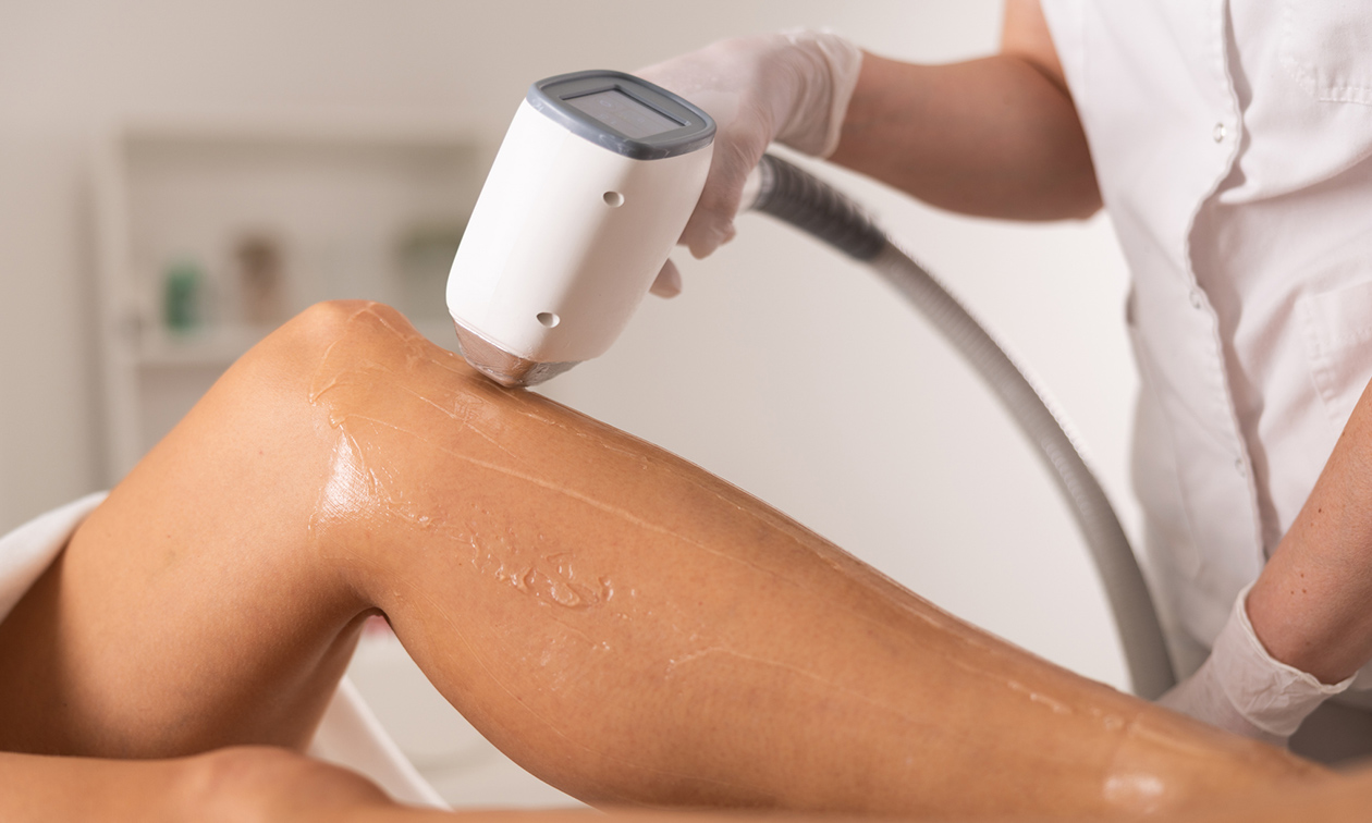NUDE - Epilation Laser