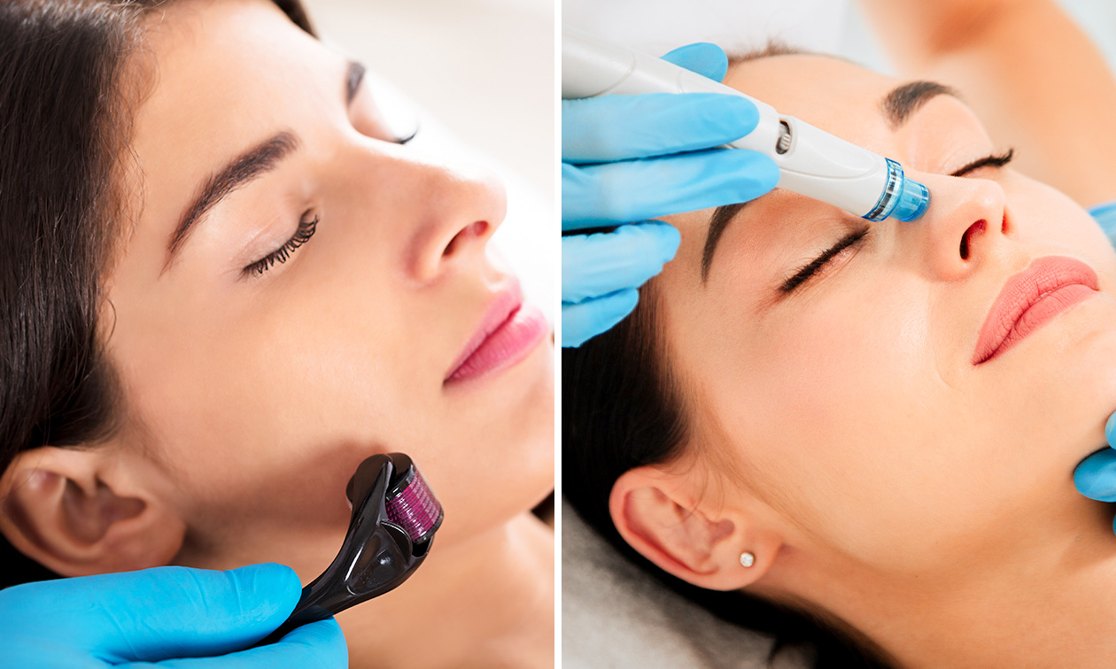 Soin visage hydratant ou microneedling (45 min) près de Lille