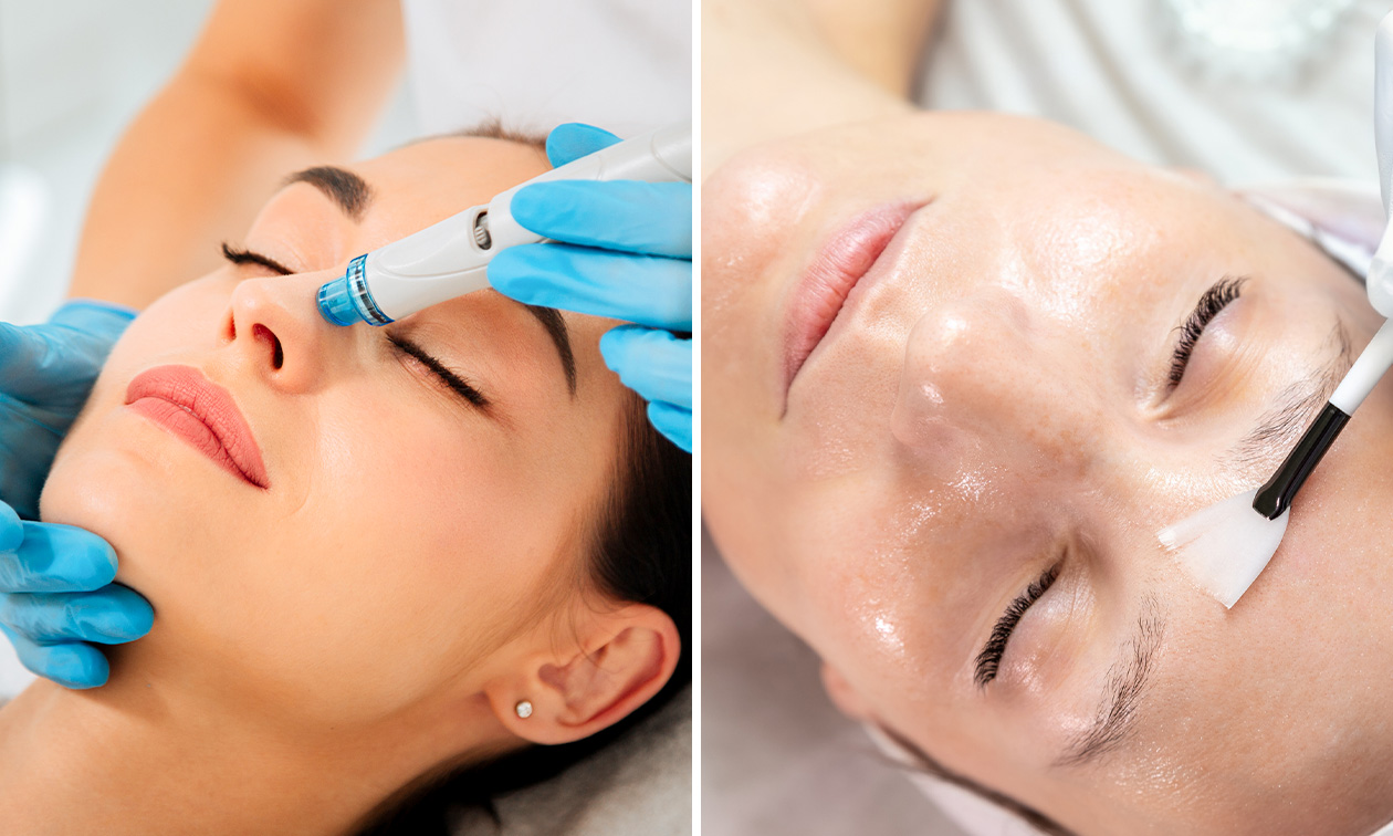 Soin Hydraskin Casmara (60 min) ou soin peeling (30 min) près de Lille