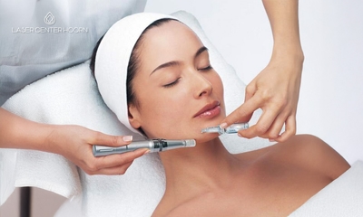 1 of 2 microneedling-behandeling(en) naar keuze (45 of 60 min)